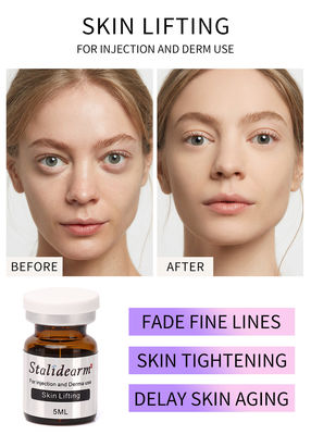 Exosomes Skin Booster Stalideram Anti-aging Skin Lifting Injecteerbare mesotherapieoplossing