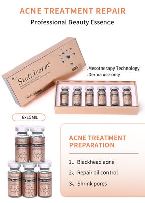 OEM ODM Stalidearm Anti Acne Serum Kruidengeneeskunde Huidverzorgingsoplossing Anti Acne Pimple Scar Remover Gezichtsserum