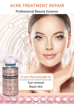 Het beste product voor de behandeling van gezichtsacne Verwijder acne gladde huid en krimp poriën Serum Verlichting Whitening Essence