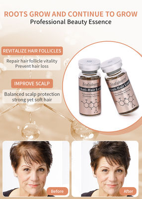De beste kwaliteit Anti Hair Loss Care Behandeling Scalp Care Prevent Hair Loss Haargroei Serum