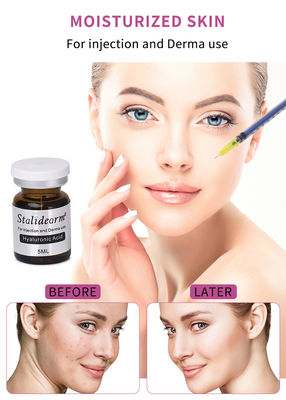 Cosmetische schoonheid 5 ml Anti Aging Microneedling Hyaluronzuur injecteerbare vulstof Injectie