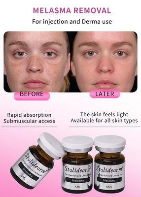5 ml anti-melasma serum vloeibare injectie set met OEM aanpassing