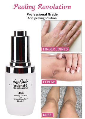 Acid Peeling Solution Liquid Set voor gezichtspeeling