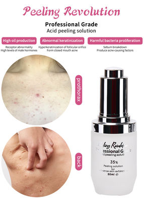 Professionele kwaliteit huid exfoliatie serum set huidverzorgingsproducten Reiniging Reparatie huid Revitalize Exfoliating oplossing