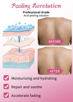 Professionele kwaliteit huid exfoliatie serum set huidverzorgingsproducten Reiniging Reparatie huid Revitalize Exfoliating oplossing