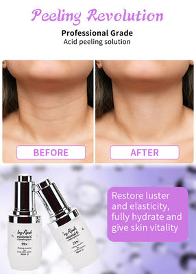 Professional Grade Gezichtspeeling Serum Set voor huid peeling oplossing