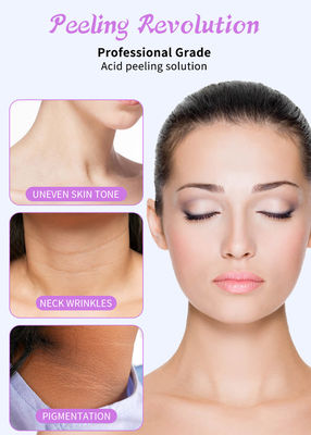Professional Grade Gezichtspeeling Serum Set voor huid peeling oplossing