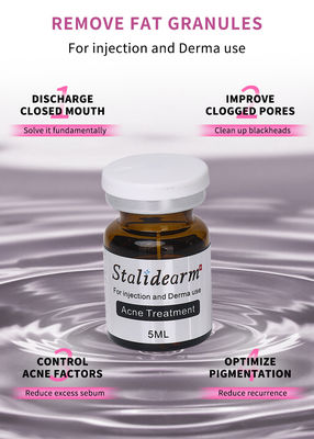 Stalidearm Dermale vulstoffen Acnebehandeling Injectie serum voor acne genezing en vlekvermindering