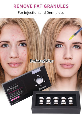 Stalidearm Dermale vulstoffen Acnebehandeling Injectie serum voor acne genezing en vlekvermindering