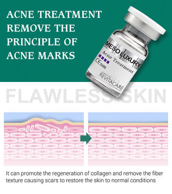 Het zuivere Duidelijke Serum dat van de Installatiepukkel Behandeling Mesotherapy voor Acnelittekens wit