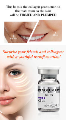 het witten van het MESO BOTOX-Serum van het Serummesotherapy van Serummicroneedling voor Gezicht