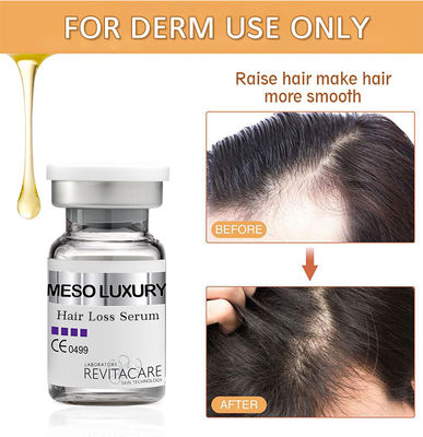 Kruiden Natuurlijk van de het Serumbehandeling 10ml van de Haarhernieuwde groei de Douane Privé Etiket