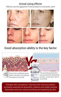de Kaviaar van Microneedling 10ml van het derma Meso Serum Ophelderend Anti het Verouderen Serum