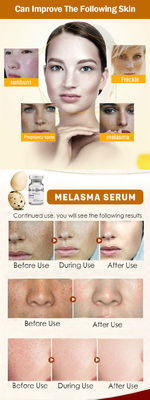 Van de de Verwijderingssproet van Microneedling van het Skincare het Meso Serum de Huid van het Serummelasma Witten