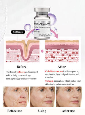 Mesotherapie Oplossing Meso luxury Cells Rejuvenating Power Serum Anti Aging Microneedling Voor Huidverheldering