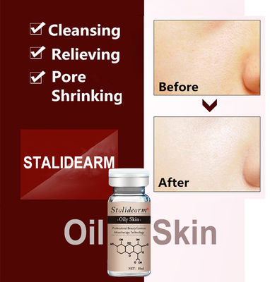 Microneedle Serum Mesotherapie Acne Behandeling Anti Acne Aangepast Label Dermal Pen Gezicht Essentie Voor Vette Huid