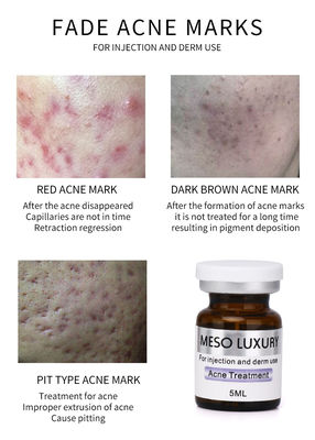 MESO LUXURY Injectie Mesotherapie Oplossing Exosomen Serum Rode Vlekken Huid Acne Behandeling