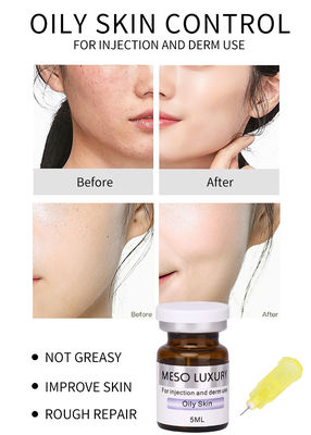 Van het de Huidsaldo van de oliecontrole Peptide van de het Serum Meso Luxe 24k Gouden OEM van het Serum Vastgestelde Privé Etiket