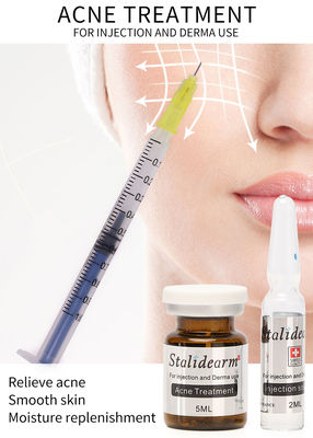 Van de de Behandelingsinjectie van de Stalidearmacne het Serum Mesotherapy die Geen Bijwerkingen voeden
