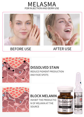 Het Effect van het het Gebruiksserum van de Melasmainjectie Veilige en Goede het serumreeks van Mesotherapy 5ml/bottle