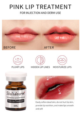 De in het groot van de het Merk Roze Lip van Stalidearm Originele van de de Behandelingsinjectie van de het Serum Veilige Essentie Meso Therapie Vastgestelde 5pcs/Set